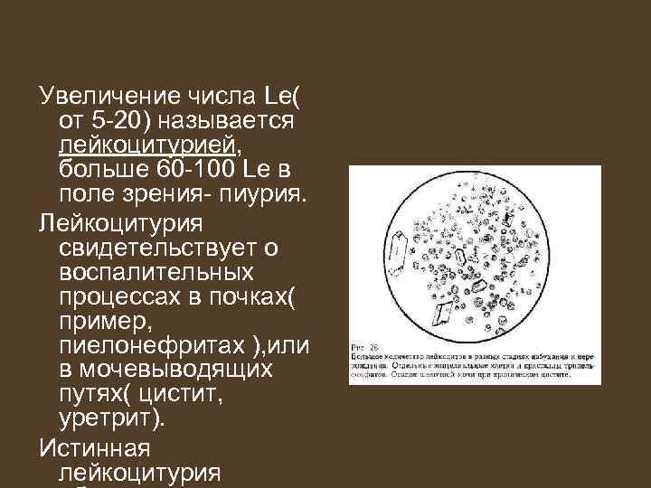 Увеличение числа Le( от 5 -20) называется лейкоцитурией, больше 60 -100 Le в поле