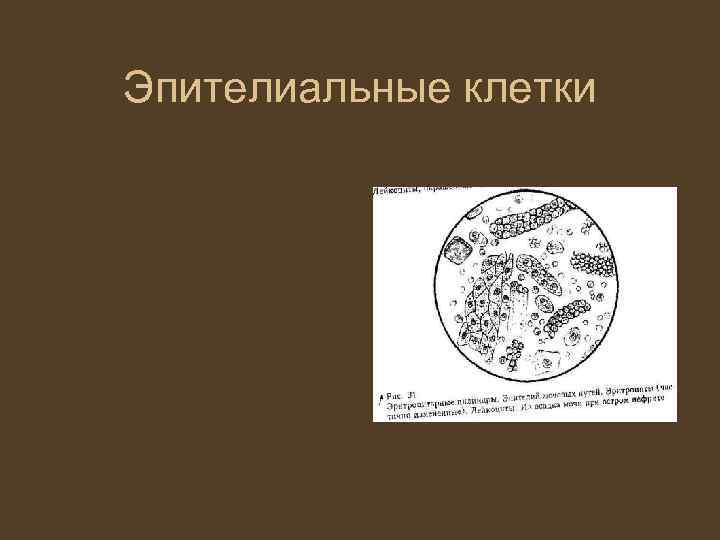Эпителиальные клетки 