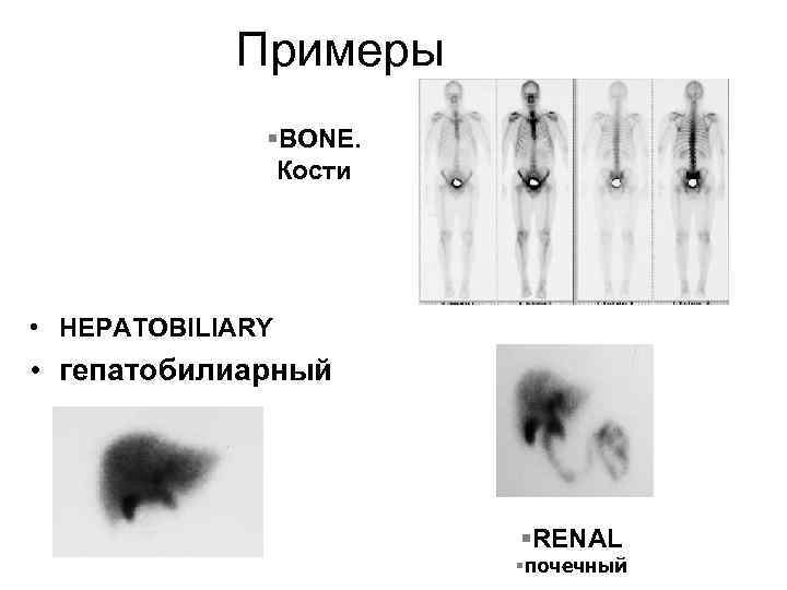 Примеры §BONE. Кости • HEPATOBILIARY • гепатобилиарный §RENAL §почечный 