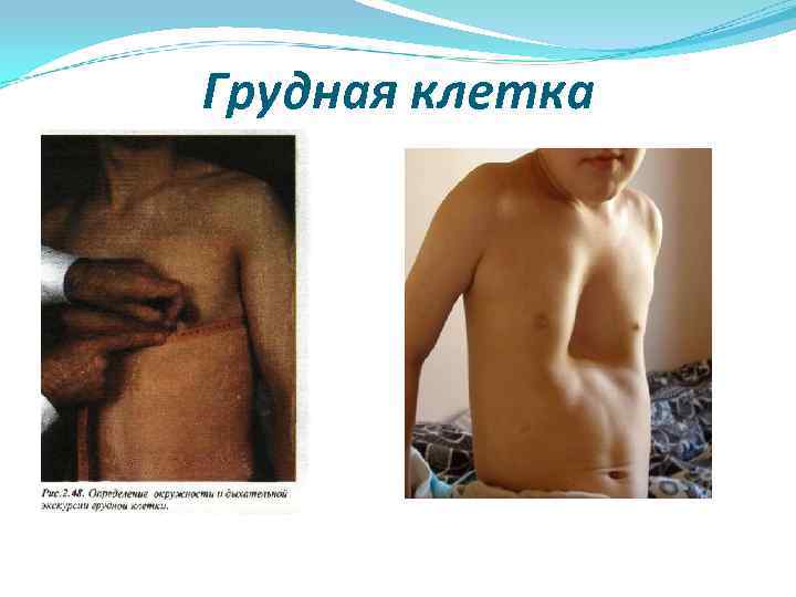 Грудная клетка 