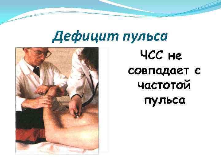 Дефицит пульса ЧСС не совпадает с частотой пульса 