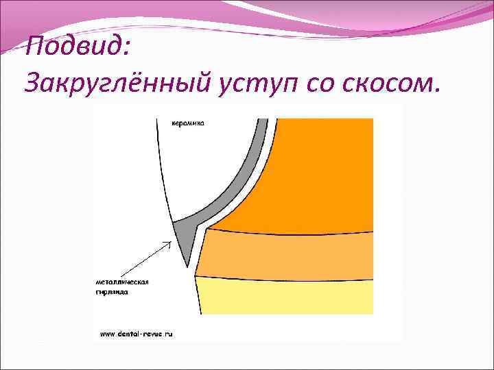 Подвид: Закруглённый уступ со скосом. 