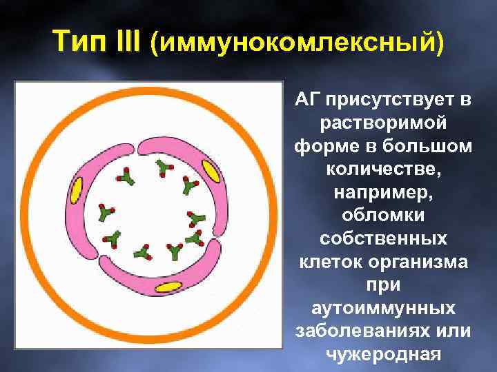 Тип III (иммунокомлексный) АГ присутствует в растворимой форме в большом количестве, например, обломки собственных