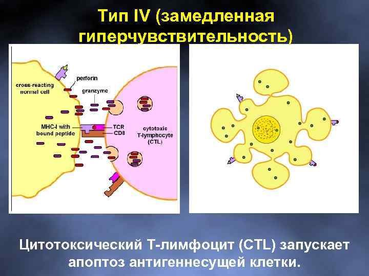 Тип IV (замедленная гиперчувствительность) Цитотоксический Т-лимфоцит (CTL) запускает апоптоз антигеннесущей клетки. 