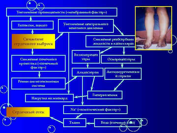 Увеличение проницаемости ( «мембранный фактор» ) Гипоксия, ацидоз Увеличение центрального венозного давления Снижение сердечного