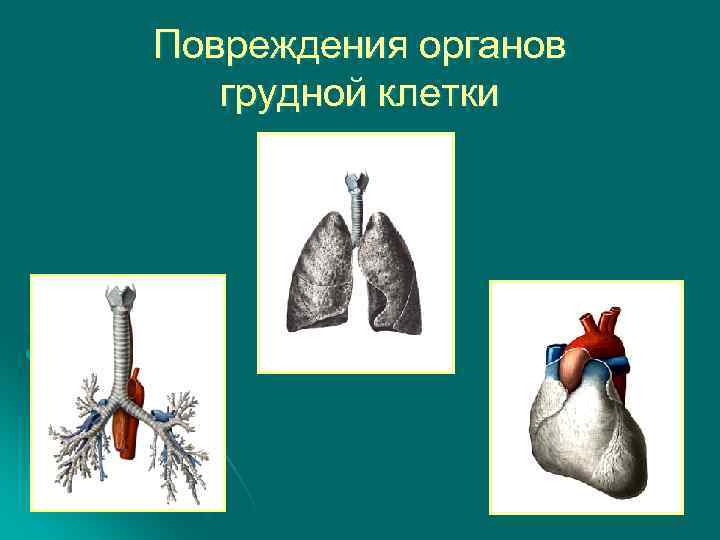 Повреждения органов грудной клетки 