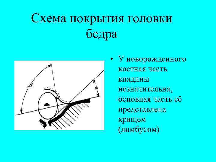 Схема покрытия головки бедра • У новорожденного костная часть впадины незначительна, основная часть её