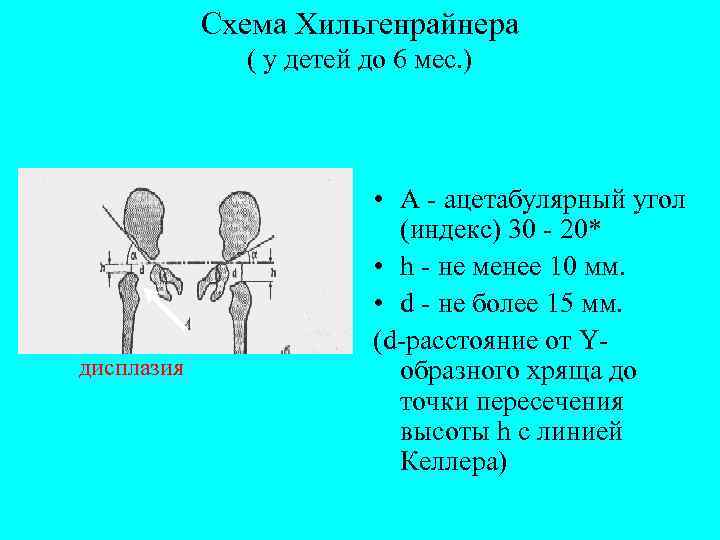 Схема хильгенрейнера тазобедренных суставов у детей