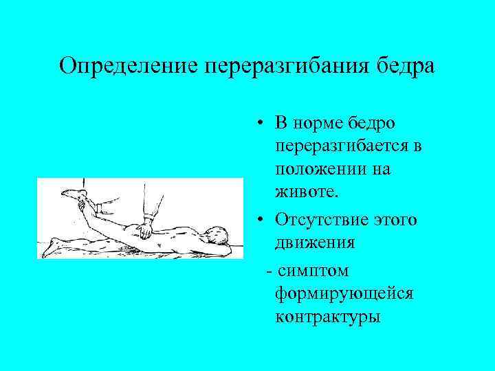 Определение переразгибания бедра • В норме бедро переразгибается в положении на животе. • Отсутствие