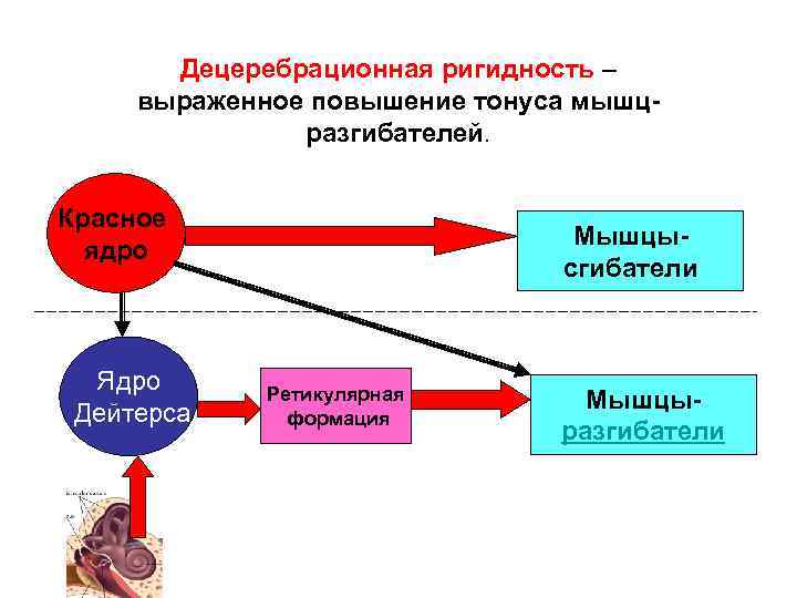 Децеребрационная ригидность – выраженное повышение тонуса мышцразгибателей. Красное ядро Ядро Дейтерса Мышцысгибатели Ретикулярная формация