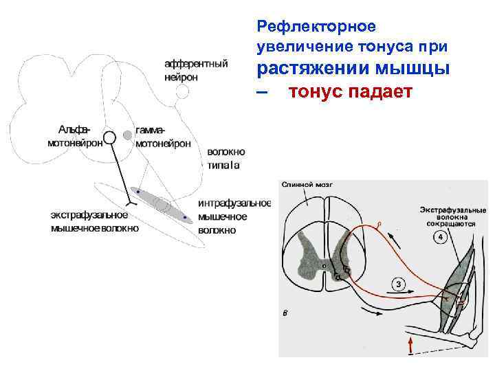 Рефлекторное увеличение тонуса при растяжении мышцы – тонус падает 