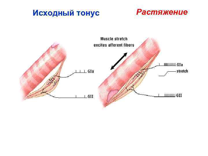 Исходный тонус Растяжение 