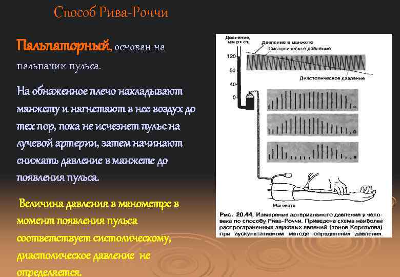 Способ Рива-Роччи Пальпаторный, основан на пальпации пульса. На обнаженное плечо накладывают манжету и нагнетают