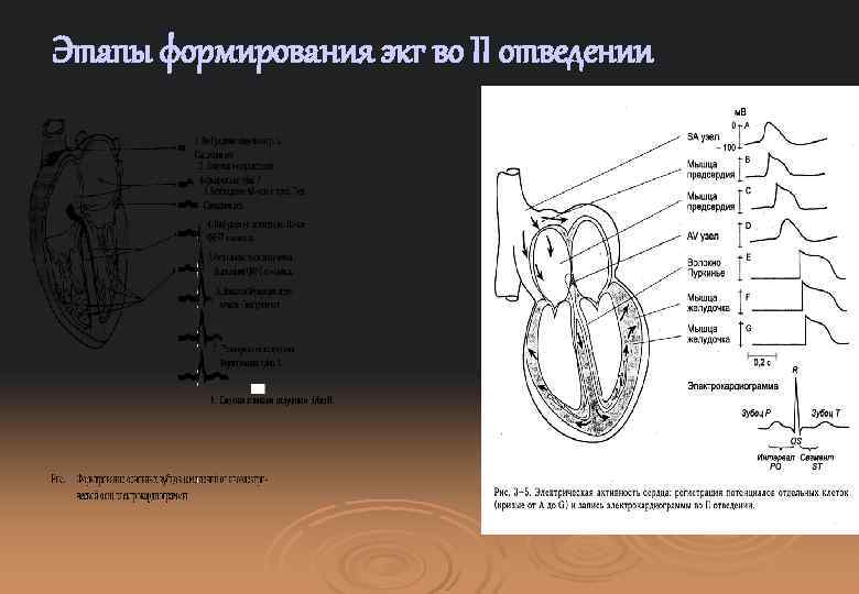 Этапы формирования экг во II отведении 