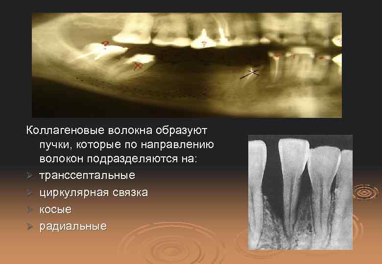 Коллагеновые волокна образуют пучки, которые по направлению волокон подразделяются на: Ø транссептальные Ø циркулярная