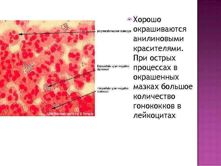  Хорошо окрашиваются анилиновыми красителями. При острых процессах в окрашенных мазках большое количество гонококков