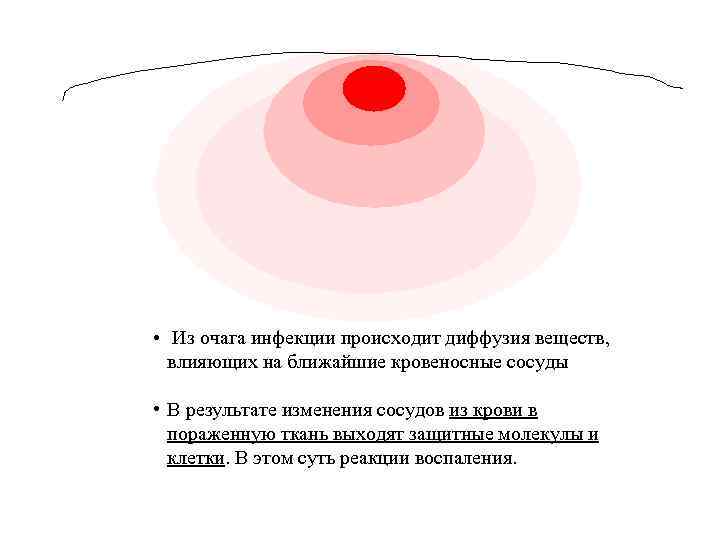  • Из очага инфекции происходит диффузия веществ, влияющих на ближайшие кровеносные сосуды •