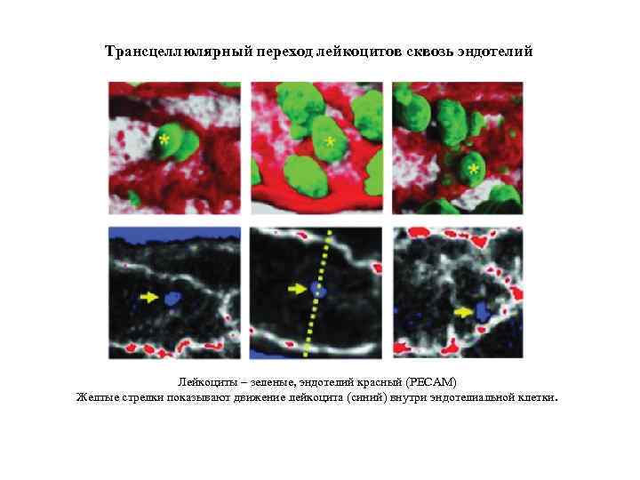 Трансцеллюлярный переход лейкоцитов сквозь эндотелий Лейкоциты – зеленые, эндотелий красный (PECAM) Желтые стрелки показывают