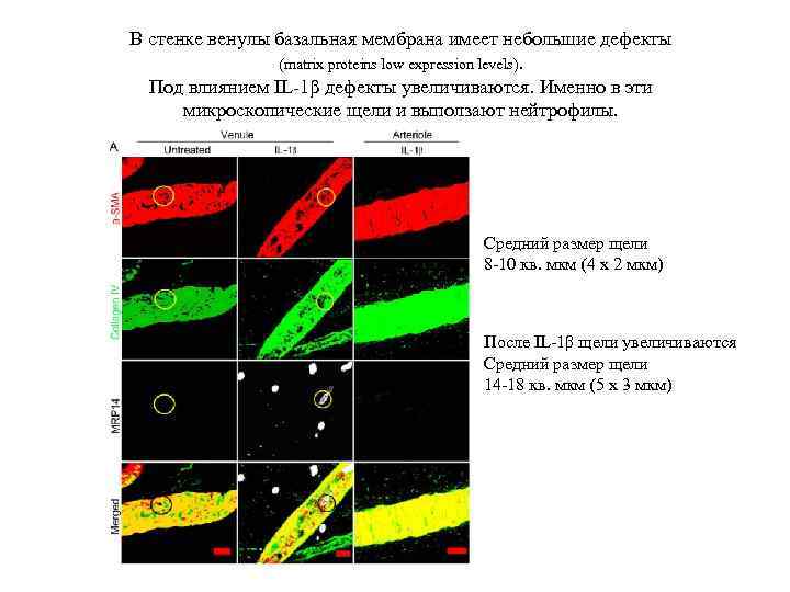В стенке венулы базальная мембрана имеет небольшие дефекты (matrix proteins low expression levels). Под