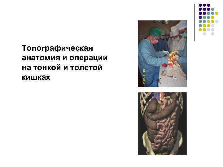 Топографическая анатомия и операции на тонкой и толстой кишках 