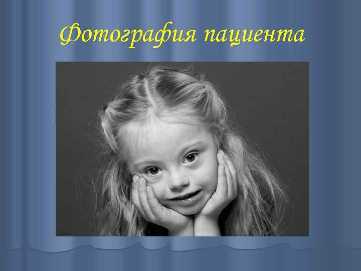 Фотография пациента 