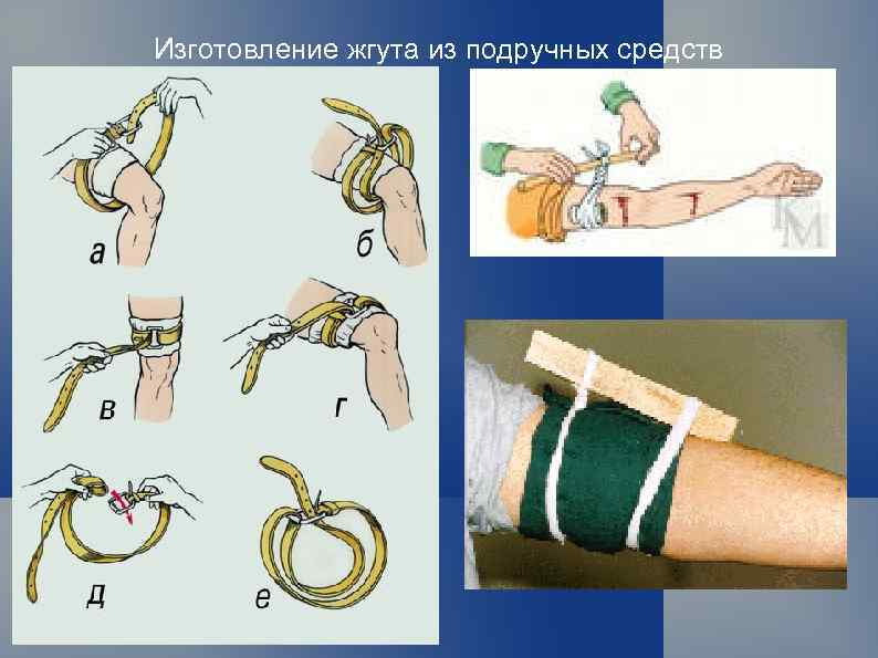 Изготовление жгута из подручных средств 