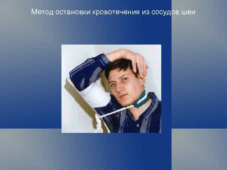 Метод остановки кровотечения из сосудов шеи 