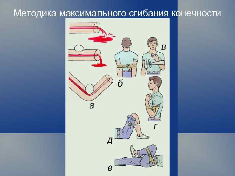 Методика максимального сгибания конечности 