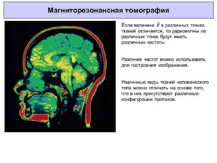 Магниторезонансная томография 
