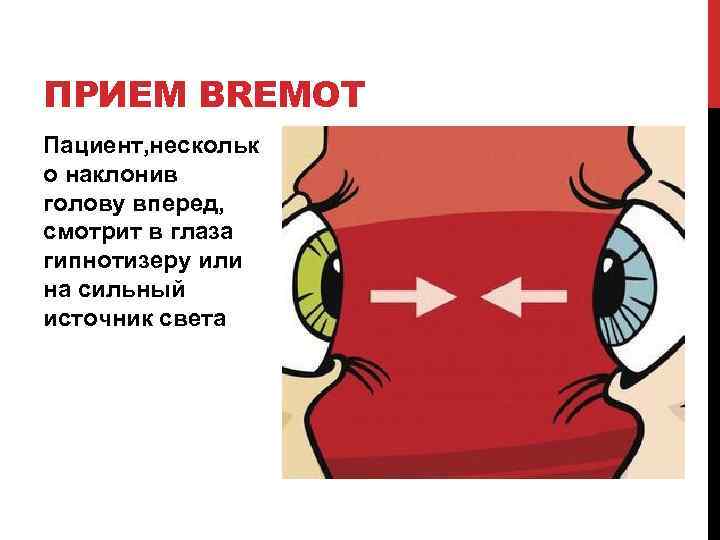 ПРИЕМ BREMOT Пациент, нескольк о наклонив голову вперед, смотрит в глаза гипнотизеру или на