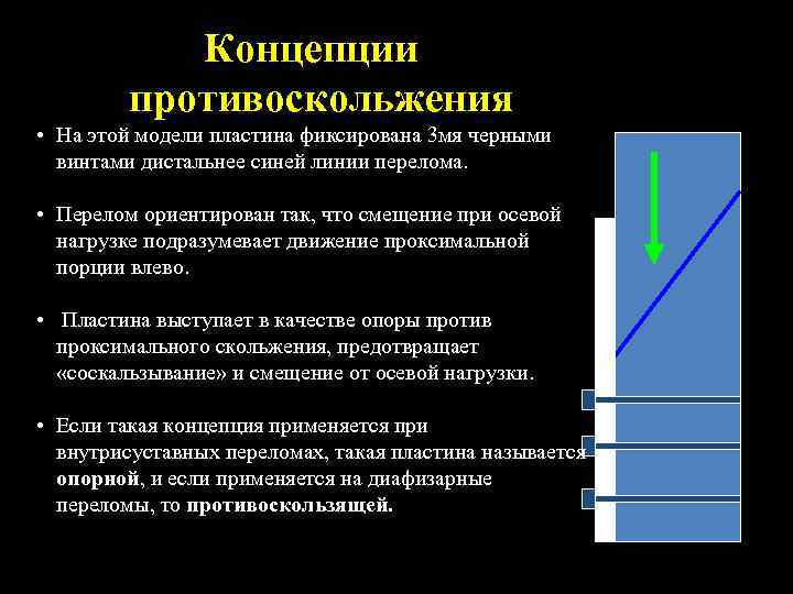 Концепции противоскольжения • На этой модели пластина фиксирована 3 мя черными винтами дистальнее синей