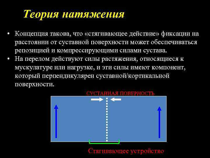 Теория натяжения • Концепция такова, что «стягивающее действие» фиксации на расстоянии от суставной поверхности