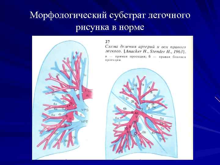 Анатомический субстрат легочного рисунка в норме это тест