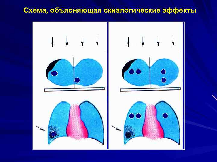 Схема, объясняющая скиалогические эффекты 