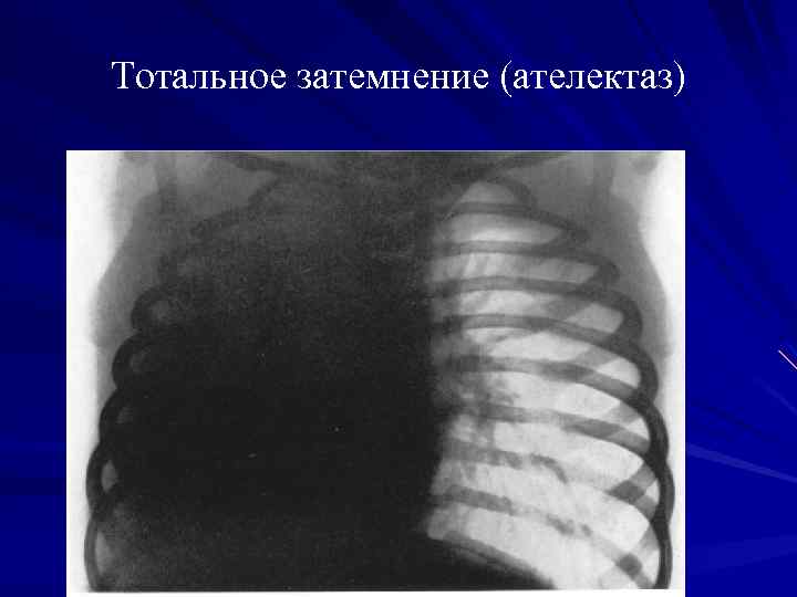 Тотальное затемнение