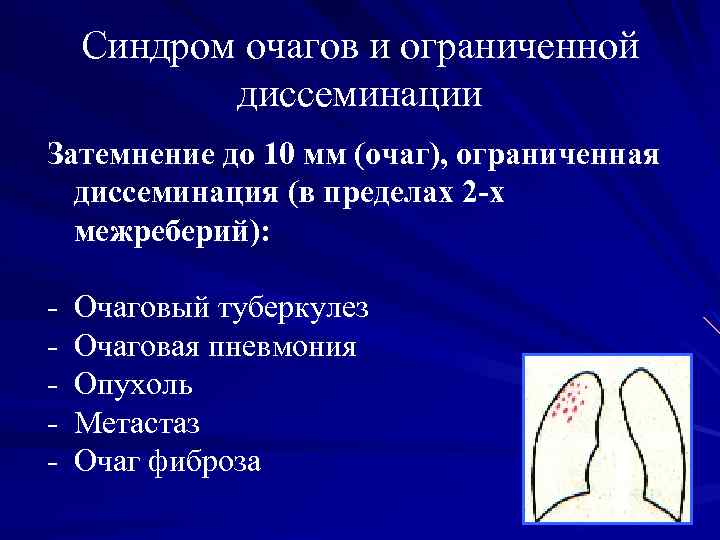 Синдром очагов и ограниченной диссеминации Затемнение до 10 мм (очаг), ограниченная диссеминация (в пределах