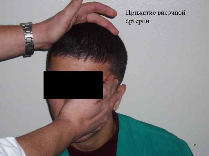 Прижатие височной артерии 41 