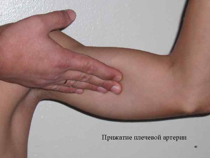 Прижатие плечевой артерии 46 