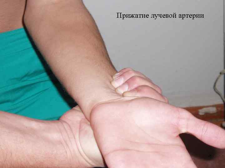 Прижатие лучевой артерии 47 