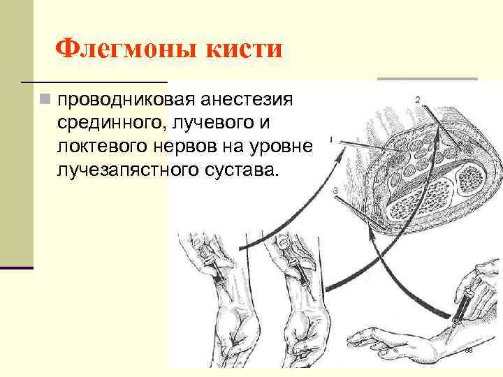 Проводниковая анестезия на лице