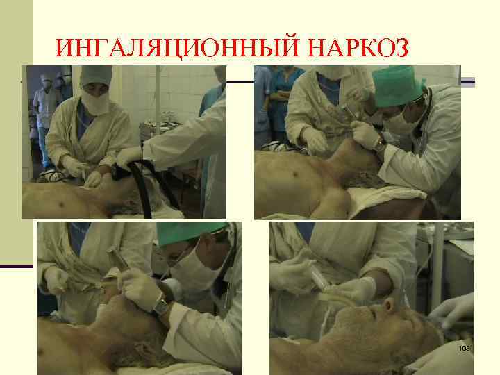 ИНГАЛЯЦИОННЫЙ НАРКОЗ 103 