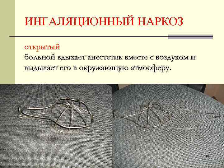 ИНГАЛЯЦИОННЫЙ НАРКОЗ открытый больной вдыхает анестетик вместе с воздухом и выдыхает его в окружающую