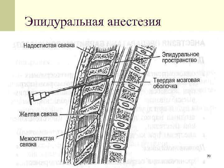 Эпидуральные роды