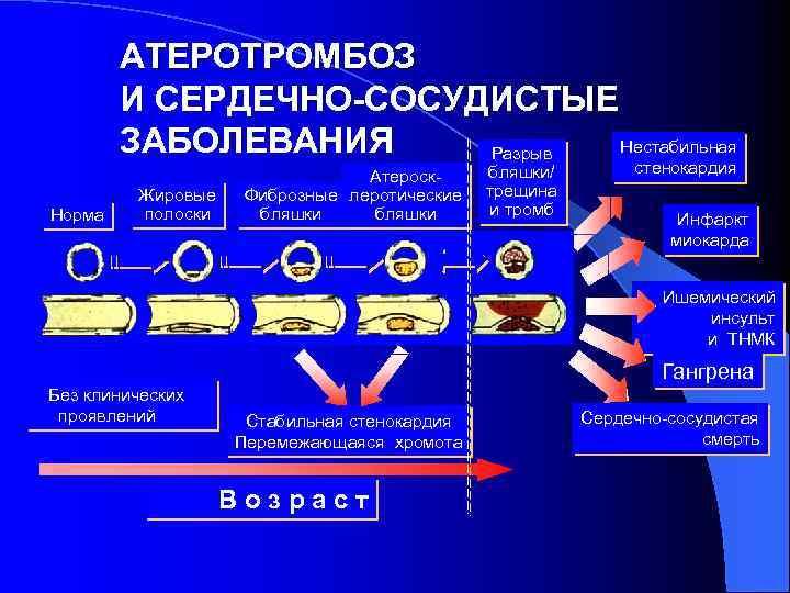 АТЕРОТРОМБОЗ И СЕРДЕЧНО-СОСУДИСТЫЕ ЗАБОЛЕВАНИЯ Нестабильная Разрыв Норма Жировые полоски Атероск. Фиброзные леротические бляшки/ трещина