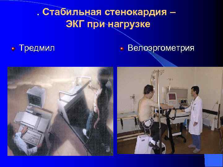 . Стабильная стенокардия – ЭКГ при нагрузке Тредмил Велоэргометрия 