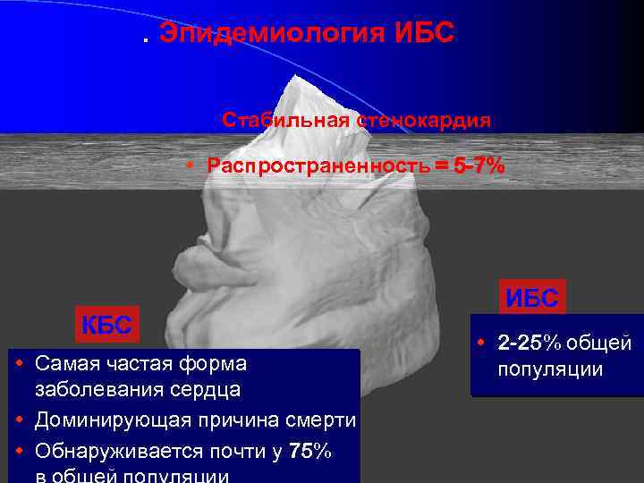. Эпидемиология ИБС Стабильная стенокардия • Распространенность = 5 -7% КБС • Самая частая
