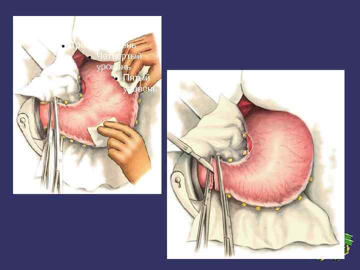 Образец текста Второй уровень Третий уровень Четвертый уровень Пятый уровень 