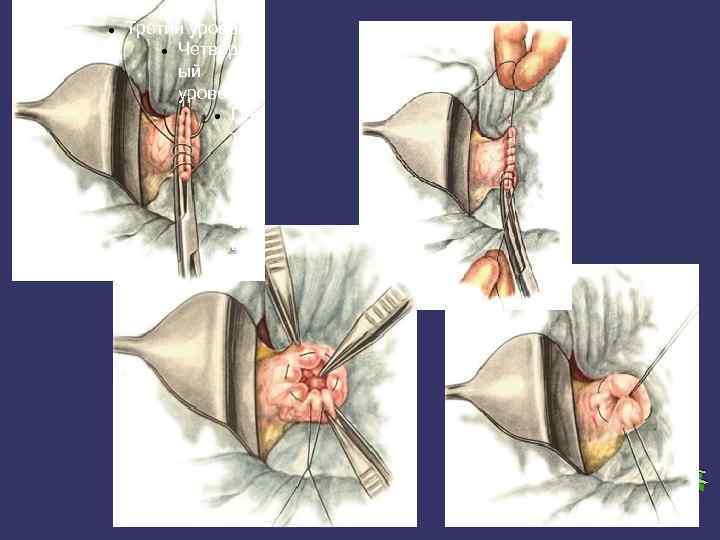 Второй уровень Третий уровень Четверт ый уровень Пя ты й ур ов ен ь
