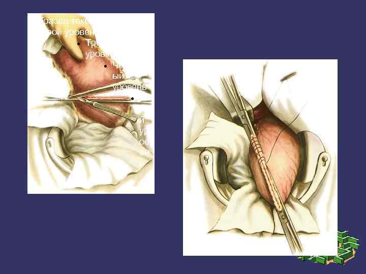Образец текста Второй уровень Третий уровень Четверт ый уровень Пя ты й ур ов