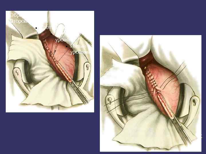 Образец текста Второй уровень Третий уровень Четвертый уровень Пятый уровень 